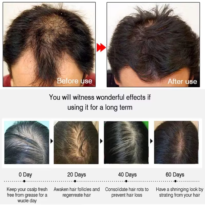 بخاخ الزنجبيل السريع لنمو الشع - مراجعة Hair Care Naturally وسعره